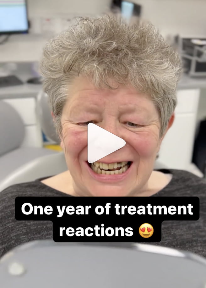 thumb1 big instagram