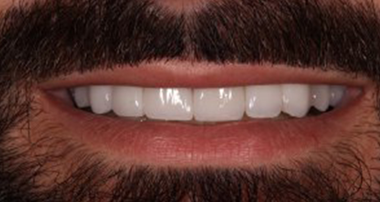 After - Deansgate Dental Studio