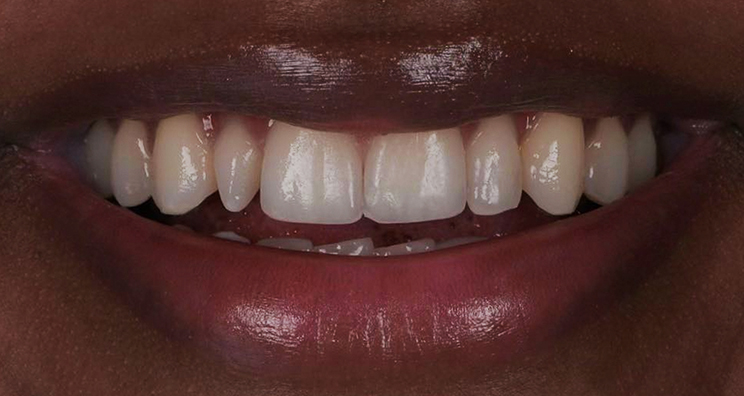 Before - Deansgate Dental Studio